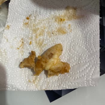 Mogaf Ümraniye Şubesinde Tavuk Dönerde Deri Parçası Bulunması Ve Hijyen Şikayeti