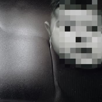 İki Kez Defolu Çerçeveli Poster, Çözüm Sunulmayan İade Talebi