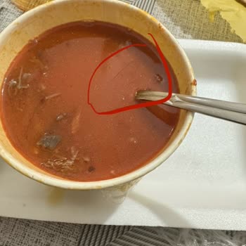 Trendyol Yemek Siparişimde Kıl Çıktı, İade Talebim Reddedildi