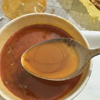 Trendyol Yemek Siparişimde Kıl Çıktı, İade Talebim Reddedildi