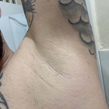 Nivea Men Deodorantı Beyaz Kalıntı Sorunu Ve İade Talebi