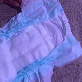 Kocaeli BİM Mağazasında Satın Alınan Jenny&Willy Bebek Bezlerinde Cırt Cırt Eksikliği