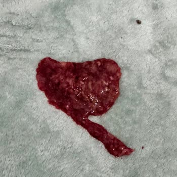 Raksharab Kuduz Aşısı Sonrası Kedimde Şiddetli Kanama Ve İç Organ Hasarı