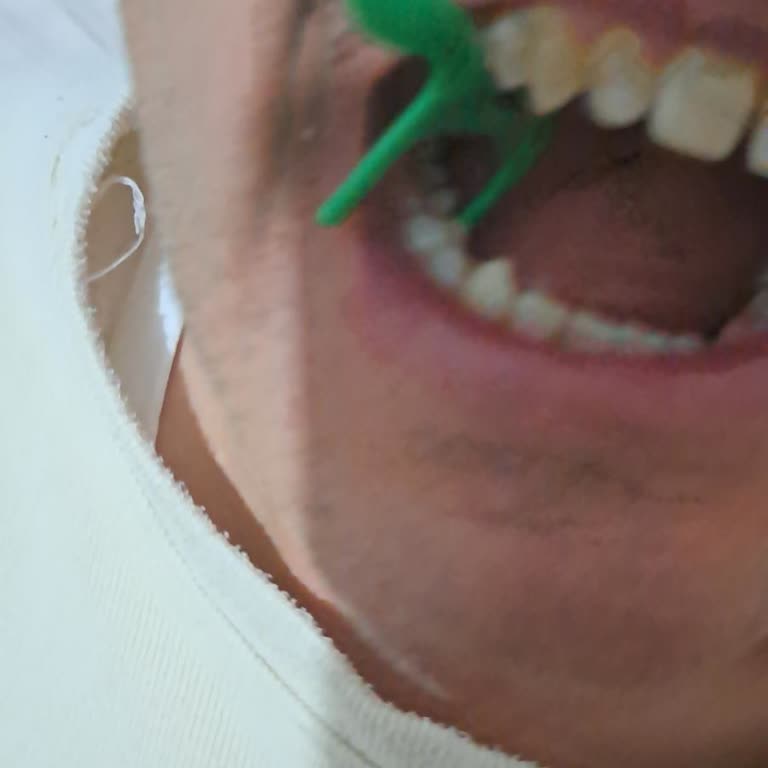 Experdent Diş İpi Sıkışıyor Ve Çıkmıyor, Müşteri Hizmetine Ulaşamıyorum