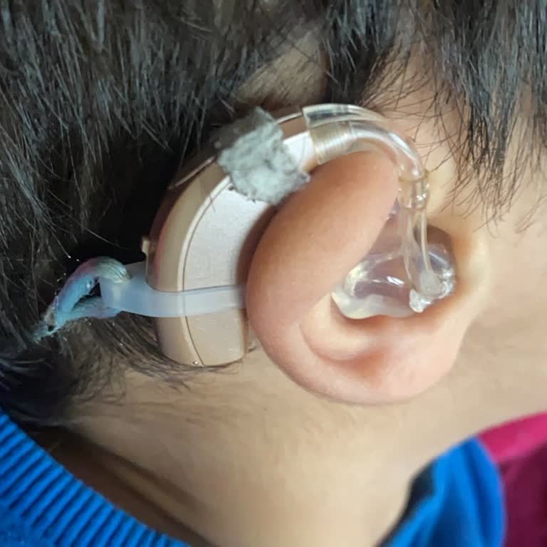 Duymer Şubesinde Garantili İşitme Cihazı İçin Yanıltıcı Ter Direnci Sözü Ve Yüksek Tamir Ücreti