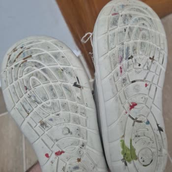 Vicco Çocuk Ayakkabısındaki Üretim Kusurları Ve İade Reddi