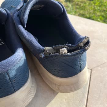 Skechers Archfit Modelinde Topuk Ayrılması ve Kullanıcı Hatası İddiası