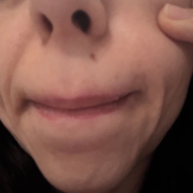 Pelin Tatlı Art & Beauty Ağda Yanığı Ve Özürsüz Tutum Nedeniyle Ücret İadesi Talebi