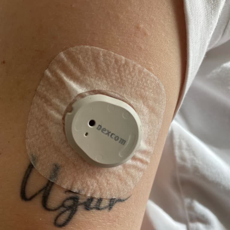 Dexcom G7 Sensörünün 24 Saatte Ayrılması Ve Arızalanması