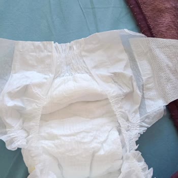 Molfix Bezlerinde Cırtcırt Kopukluğu Ve Kalite Sorunu