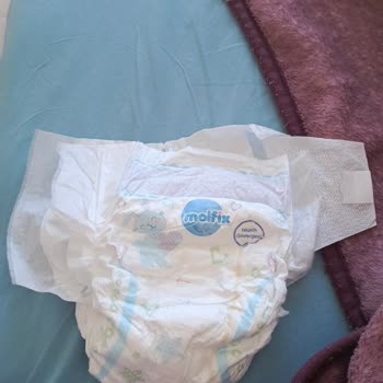 Molfix Bezlerinde Cırtcırt Kopukluğu Ve Kalite Sorunu