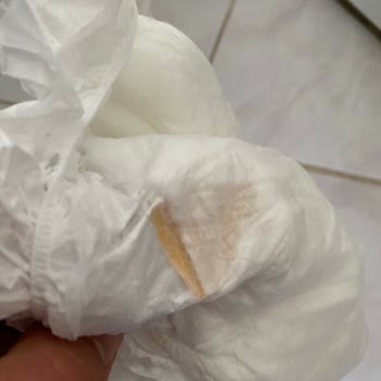 Bebek Bezinde Gizli Bant Yara Açtı, Güvenlik Ve Hijyen İhlali