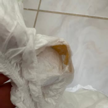 Bebek Bezinde Gizli Bant Yara Açtı, Güvenlik Ve Hijyen İhlali