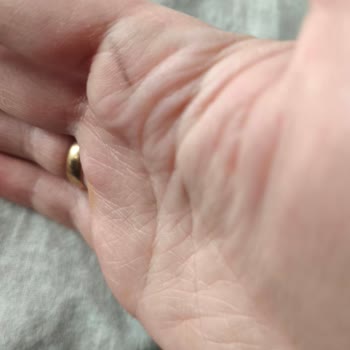 Homend İlk Kullanımda Elektrik Çarpması Ve Yanık Yaratan Mutfak Robotu İadesi