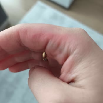 Homend İlk Kullanımda Elektrik Çarpması Ve Yanık Yaratan Mutfak Robotu İadesi