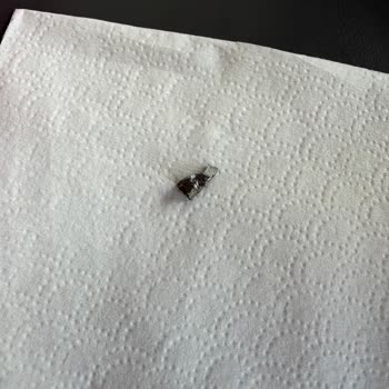 Dönerde Metal Parça Ve Çalışanların Umursamaz Tutumu