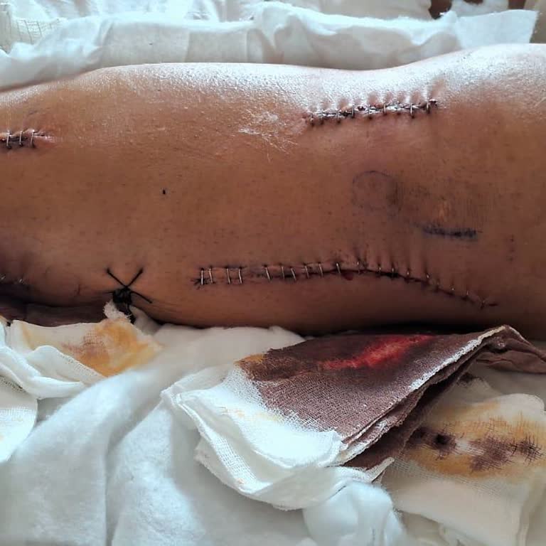 Kaza Sonrası Ferdi Kaza Sigortam Aktif Edilmedi Ve Haksız Red