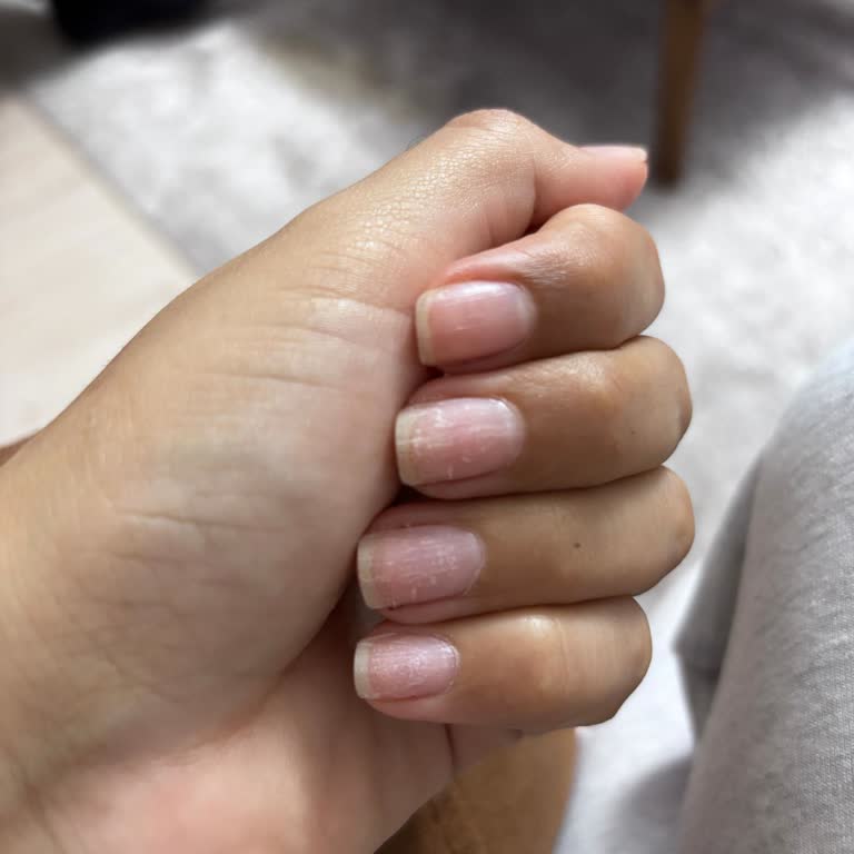 Üç Gün Sonra Çöken Kalıcı Oje Ve İade Talebi