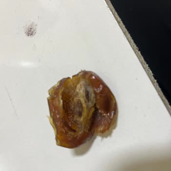 Hurmanın İçinden Kurt Çıktı: Çerezya Meyvesinde Hijyen Ve Güven Sorunu