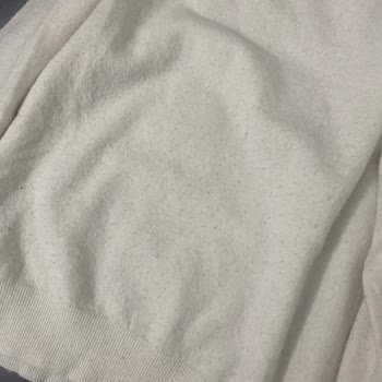 Yünlü Kazakta Aşırı Tüylenme Ve İade Talebi