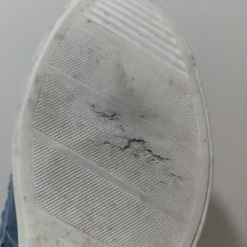 Ayıplı Ayakkabı Nedeniyle 1500 TL İadesi Talebi