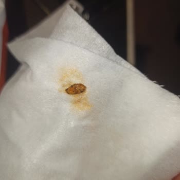 Nehir Market’ten Alınan Cips Paketi İçinde Fare Dışkısı Benzeri Kirlilik