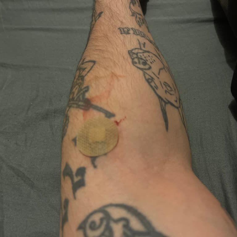 File Market'ten Alınan Mantar Zehirlenmesiyle 7 Saatlik Acil Hastane Tedavisi