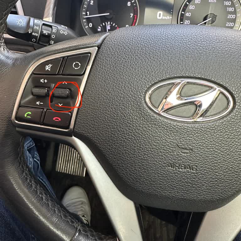 Direksiyon Radyo Kanal Tuşu Bozuldu Yedek Parça Temini Ve Çözüm Talebi