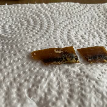 Star Krak Nohut Cipsinde Yabancı Cisim Tespit Edildi