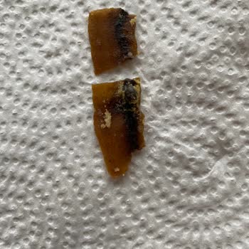 Star Krak Nohut Cipsinde Yabancı Cisim Tespit Edildi