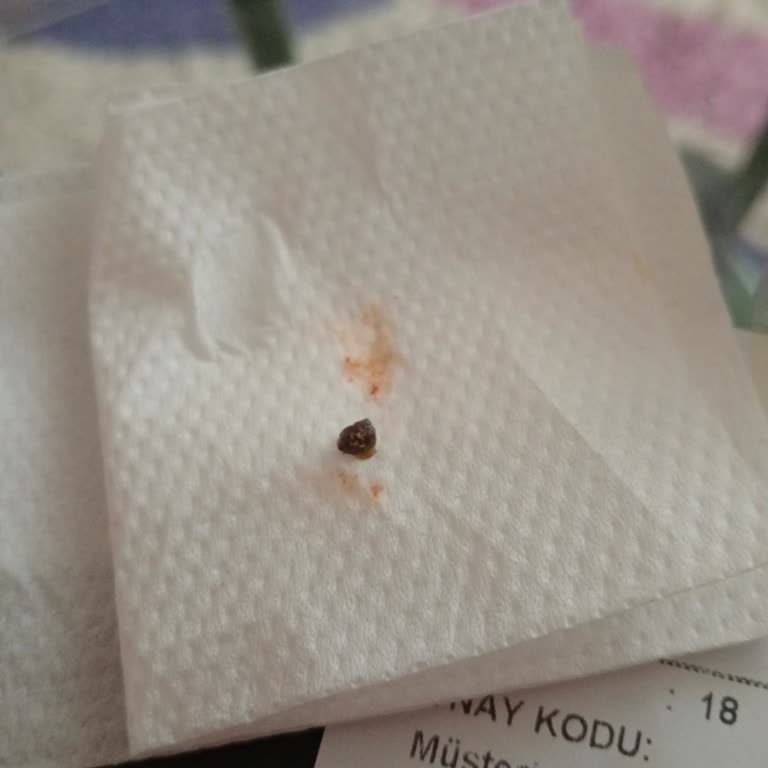 Bursa Maydanoz Döner’de Dürümde Taş Bulunması Ve İade Talebi