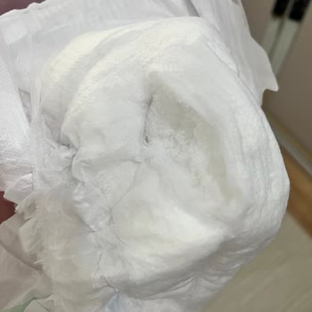 Molfix Bebek Bezinde Kristalleşme Sorunu Ve Cilt Kızarıklığı