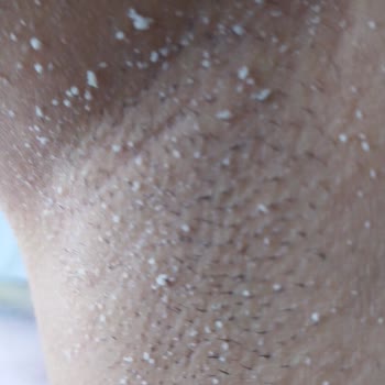 Nivea Koltuk Altı Stik Deodorantı Erimiyor Ve Parçalar Dökülüyor