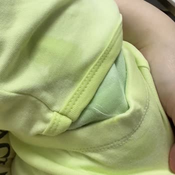 Sleepy Bebek Bezinde Arka Sızıntı Sorunu Ve Geri Ödeme İsteği