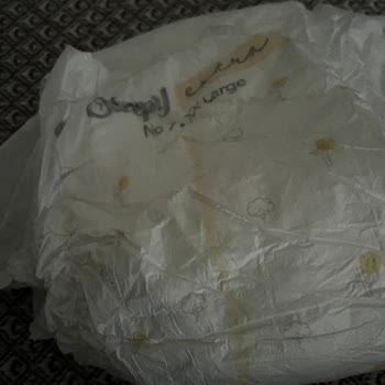 Sleepy Bezlerinde Emicilik Sorunu Çocuğumun Sağlığını Tehdit Ediyor