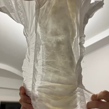 Sleepy Bezlerinde Emicilik Sorunu Çocuğumun Sağlığını Tehdit Ediyor