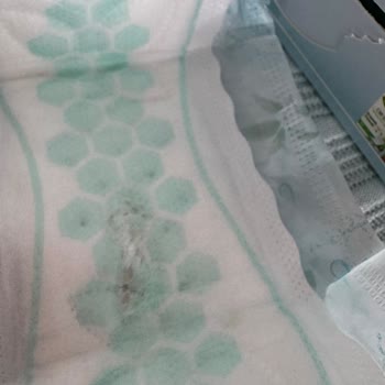 Molped Günlük Pedinde Hijyenik Olmayan Bozulma Ve Güven Sorunu