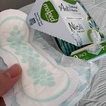 Molped Günlük Pedinde Hijyenik Olmayan Bozulma Ve Güven Sorunu