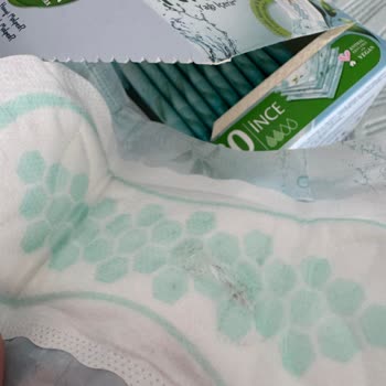 Molped Günlük Pedinde Hijyenik Olmayan Bozulma Ve Güven Sorunu