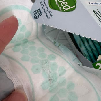 Molped Günlük Pedinde Hijyenik Olmayan Bozulma Ve Güven Sorunu