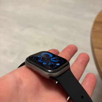 Media Markt'ta Apple Watch Ekran Koruyucu Sorunu Ve 599 TL İade İsteği