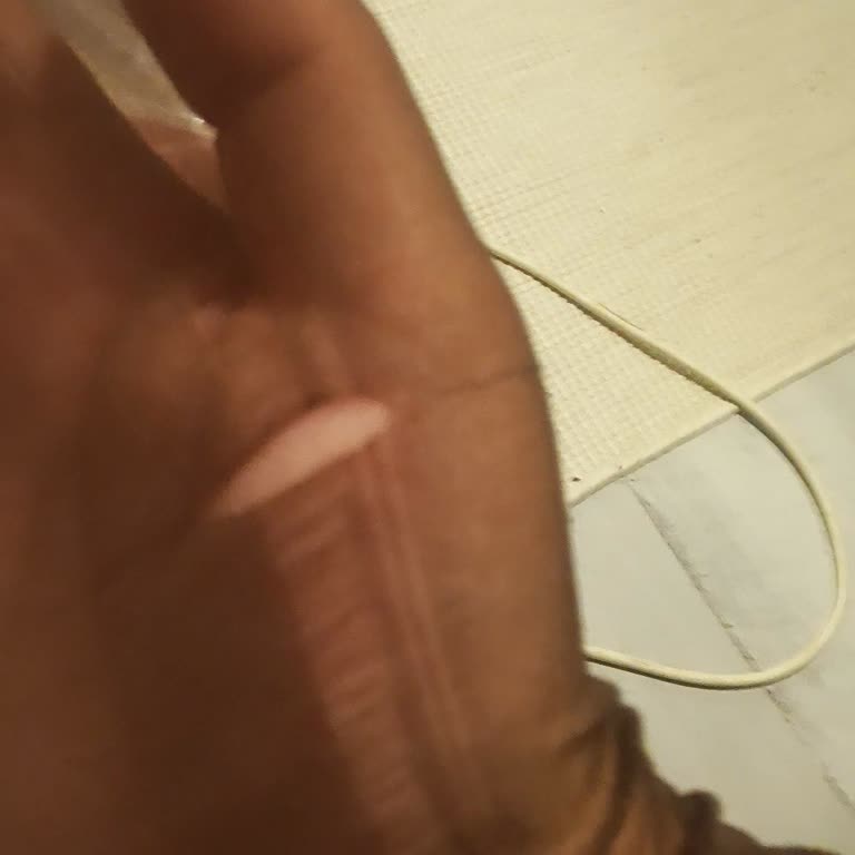 Üretim Hatası: İlk Kullanımda Çorap Kaçtı, Ücret İadesi Talebi