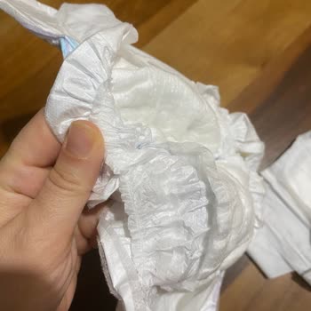 Molfix Junior Bezlerde Patlayan Paketler Ve Ürün Değişimi Talebi