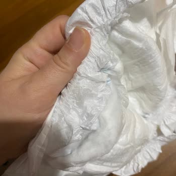 Molfix Junior Bezlerde Patlayan Paketler Ve Ürün Değişimi Talebi