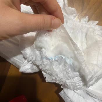 Molfix Junior Bezlerde Patlayan Paketler Ve Ürün Değişimi Talebi