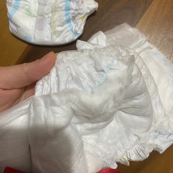 Molfix Junior Bezlerde Patlayan Paketler Ve Ürün Değişimi Talebi