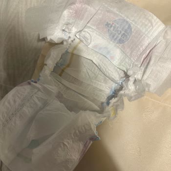 Molfix Bebek Bezinde Üretim Hatası: İç Dolgu Yok, Güvenlik Sorunu