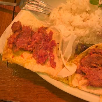 Müdavim Pide Salonu’nda Çiğ Kebap Ve Taş Büyüklüğünde Kıkırdak Sorunu