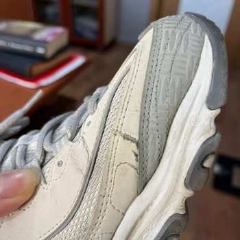 Skechers Ayakkabım Hızla Deforme Oldu Ve Garanti Şartları Yetersiz