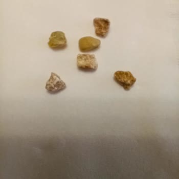 Migros Mercimeğinde Çıkan Taş Çocuğumun Dişini Kırdı